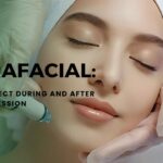 Hydra Facial