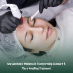 Micro Needling Treatment