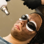 Anti-Ageing Laser, Anti-Ageing Laser Treatments, Best & Anti-Ageing Laser Treatments