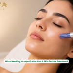 Microneedling Treatment in Jaipur