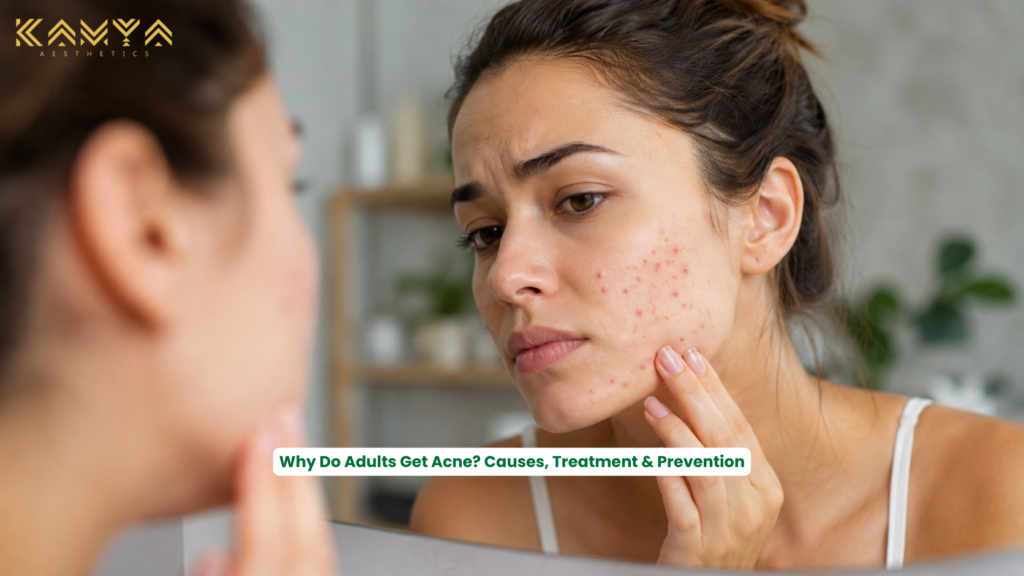 Adult woman with adult acne and clear skin contrast, showing professional acne treatment and healthy glowing skin at a modern aesthetic skin clinic in Jaipur.